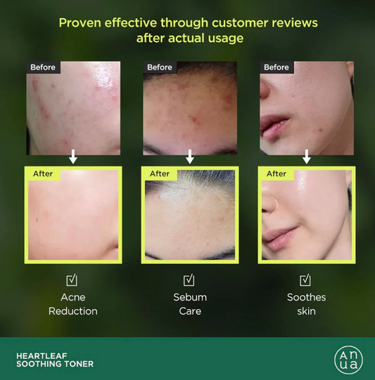 ANUA Heartleaf 77% Soothing Toner 250mL