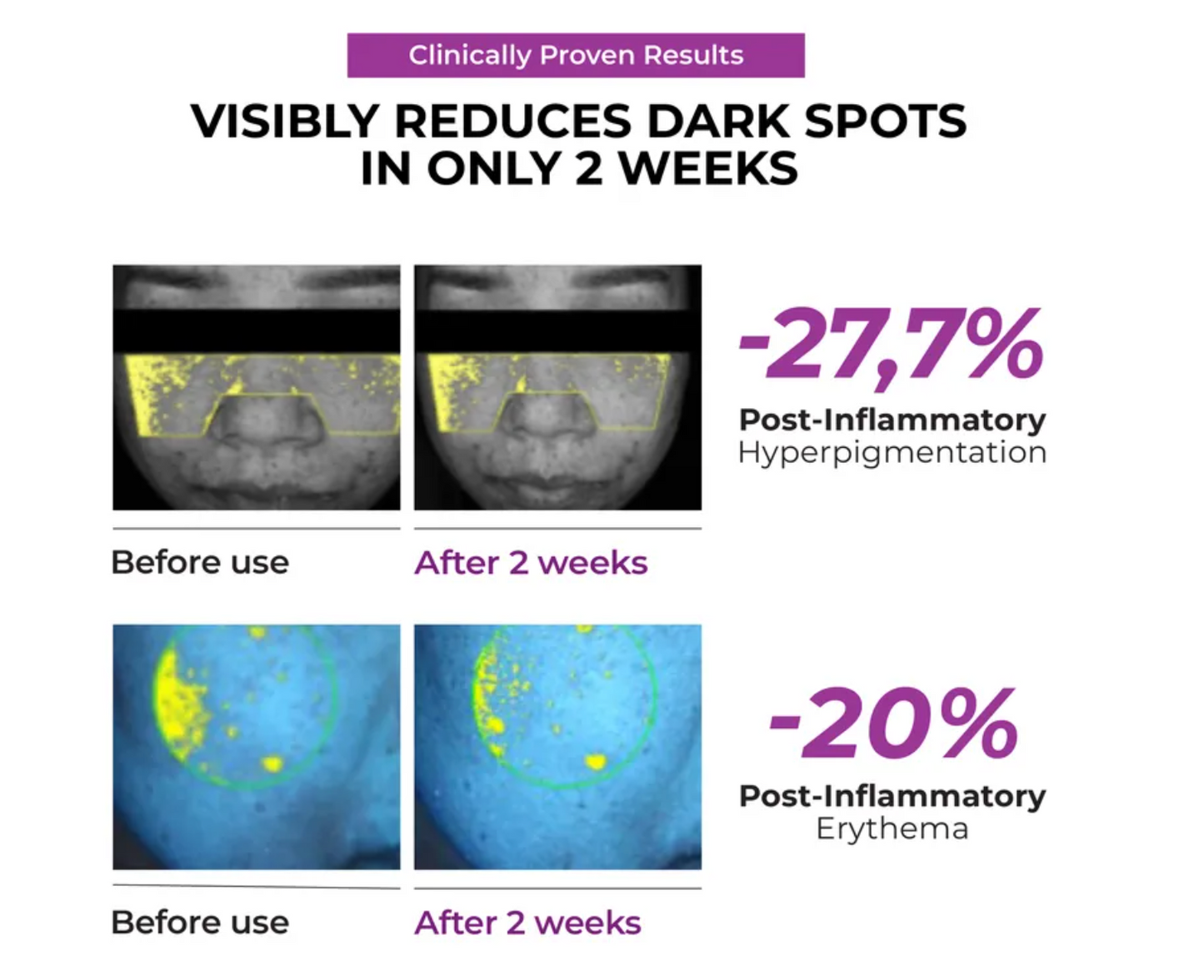 Jumiso - Niacinamide 20 serum 40ml