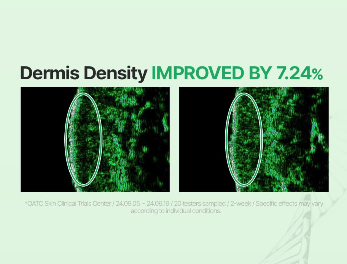 Z+piderm - EGF Skin Barrier Intensive Cream 80ml