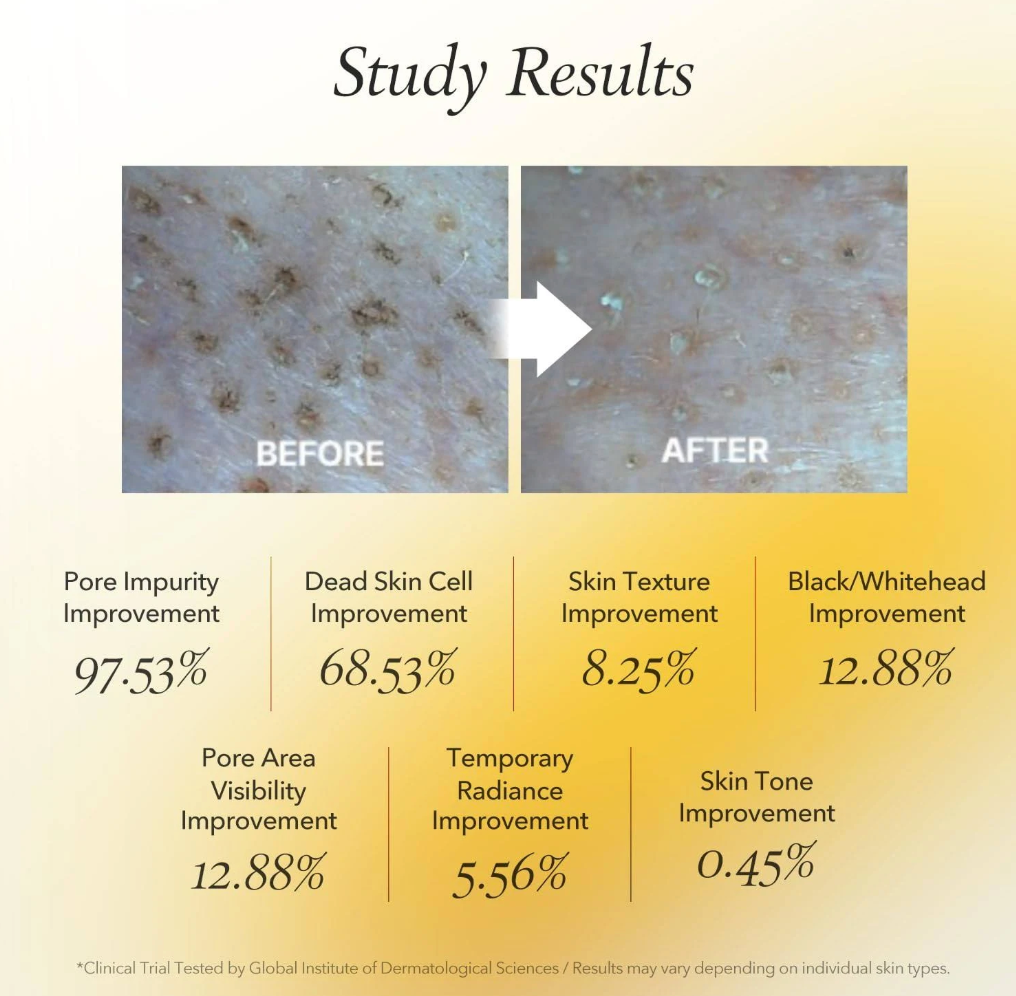 APRILSKIN Real Calendula Peel Off Pack 100g