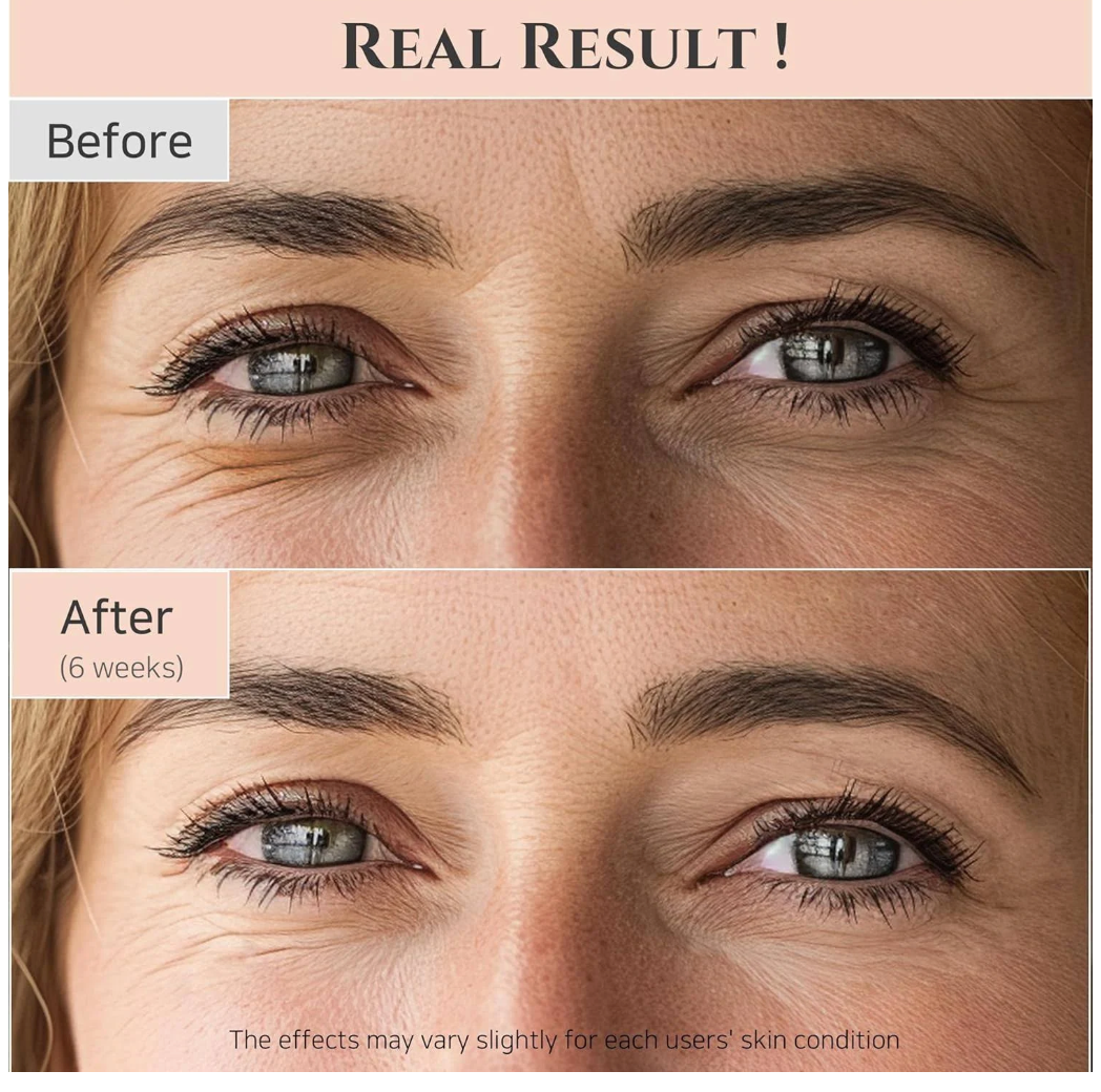 Beauty of Joseon - Revive Eye Serum : Ginseng + Retinal (DAMAGED BOX)