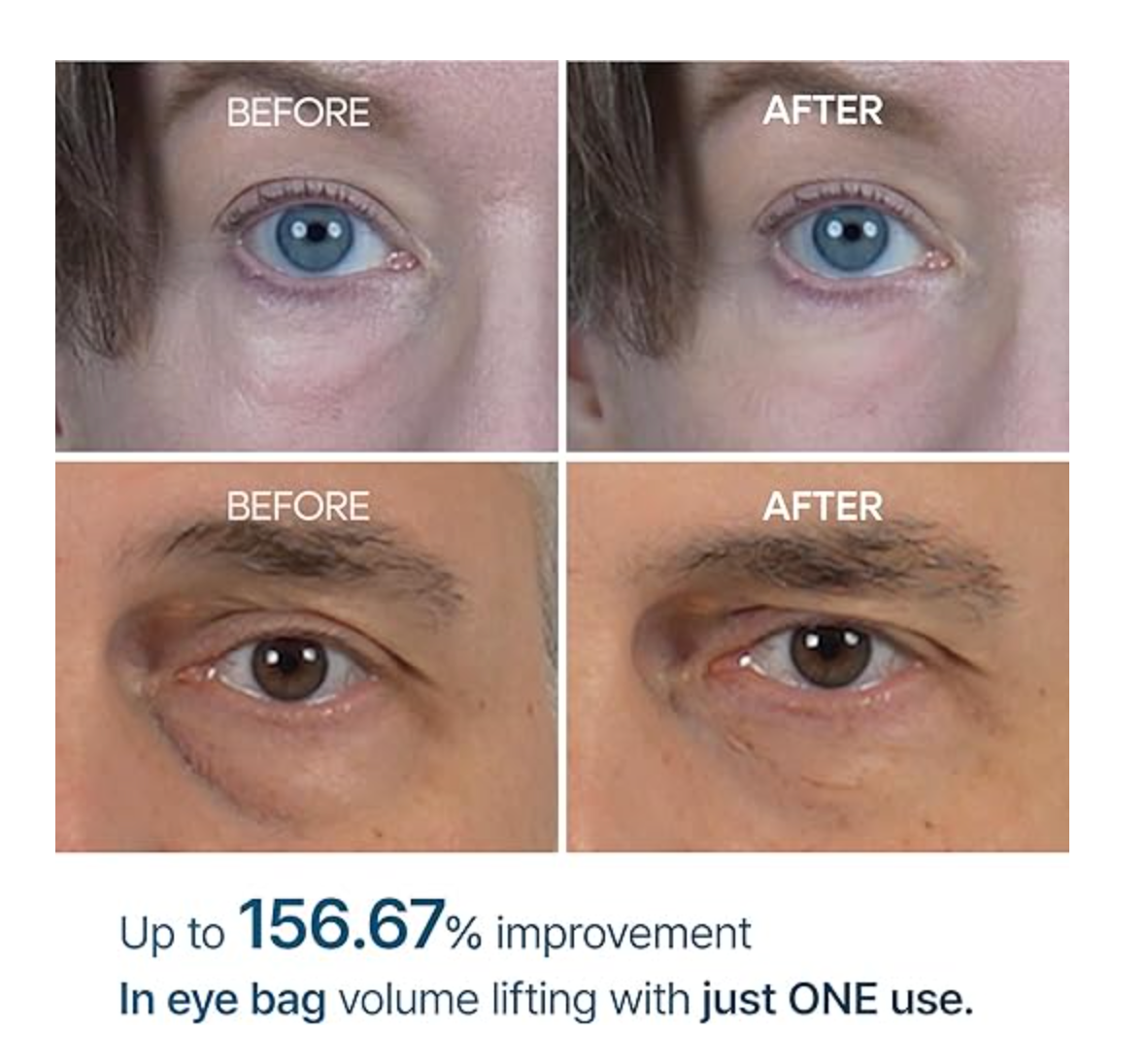 Dr Melaxin - Eyephalt (Eyebag Cream) 10g