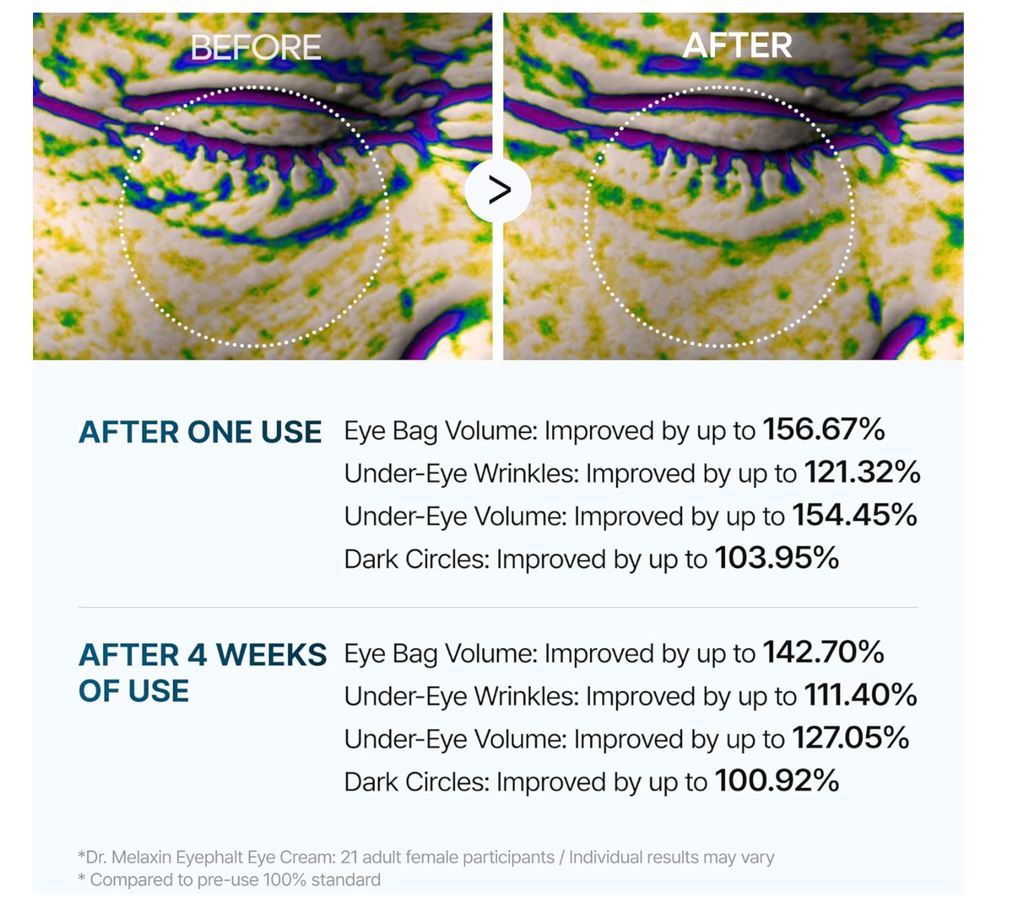 Dr Melaxin - Eyephalt (Eyebag Cream) 10g