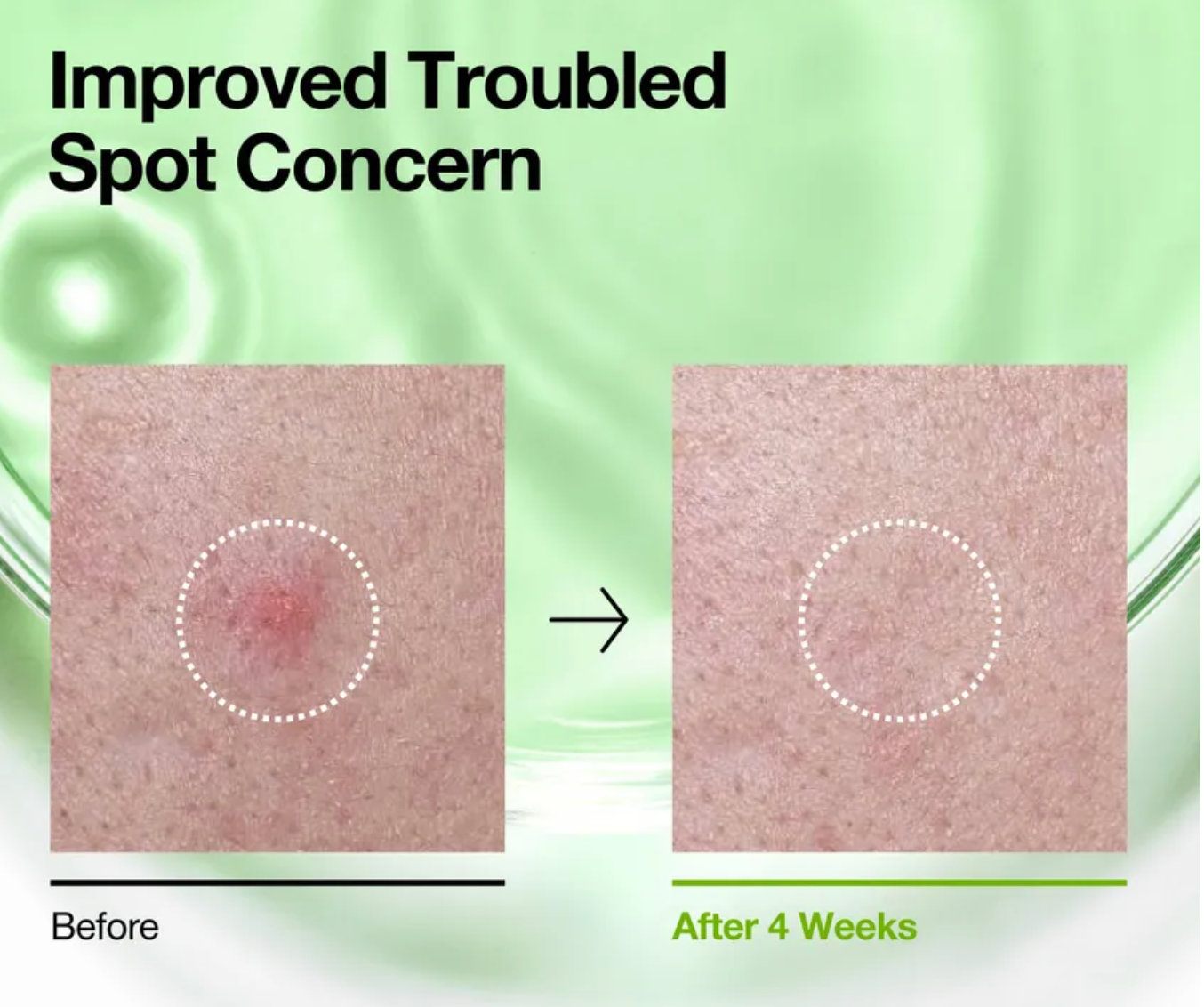 Anua - Azelaic Acid 3 + Cica Toner 250ml