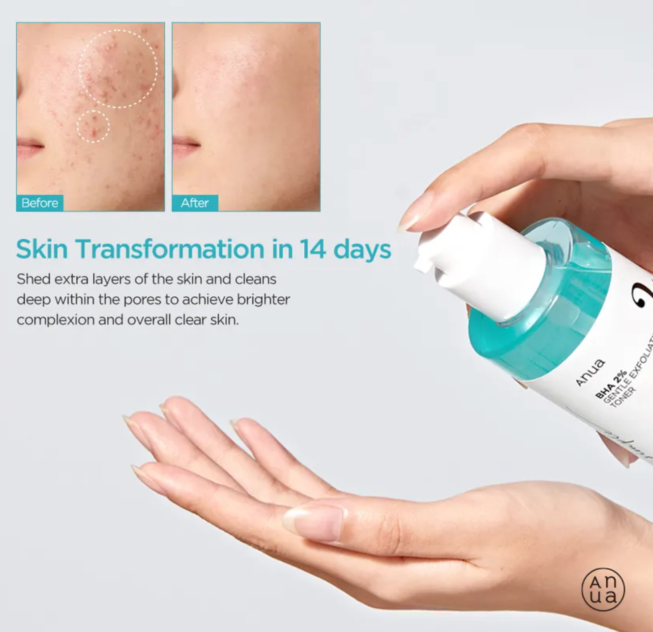 Anua - BHA 2% Gentle Exfoliating Toner 150ml