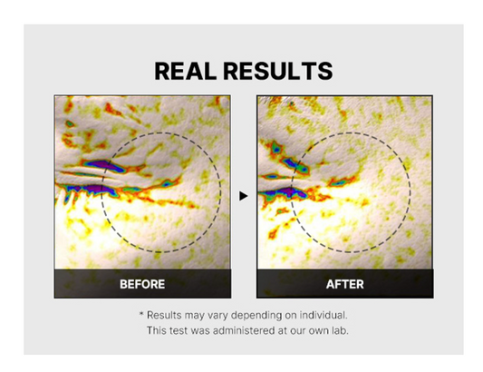 [Medicube] DEEP LIFTING PEPTIDE EYECREAM FOR FACE 30ml