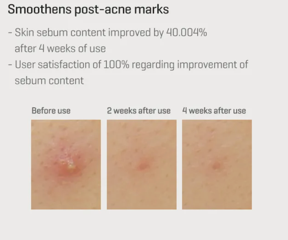 SOME BY MI - Retinol Intense Reactivating Serum