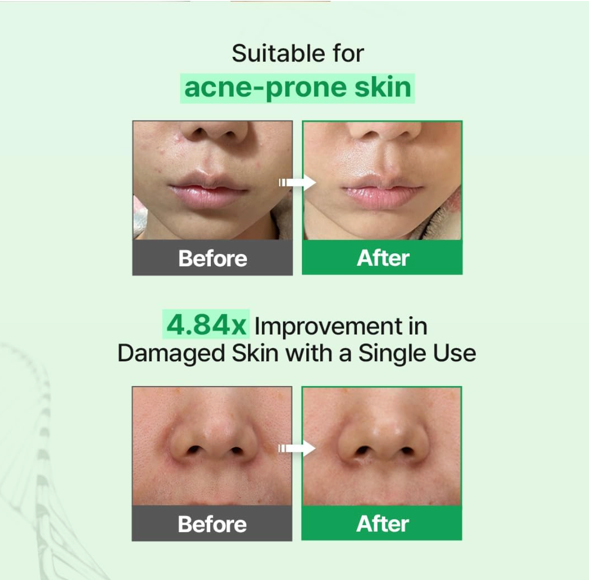 Z+piderm - EGF Skin Barrier Cream Toner