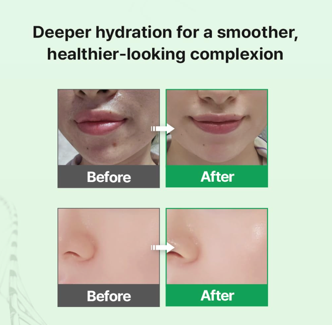 Z+piderm - EGF Skin Barrier Hydro Ampoule 30ml