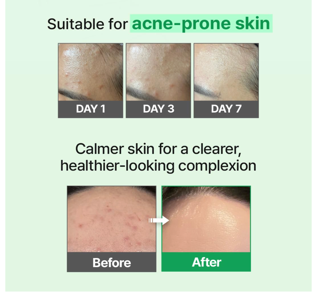 Z+piderm - EGF Skin Barrier Intensive Cream 80ml