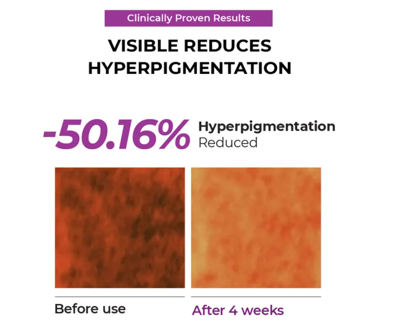 JUMISO - Niacinamide 5+ Overnight Cream