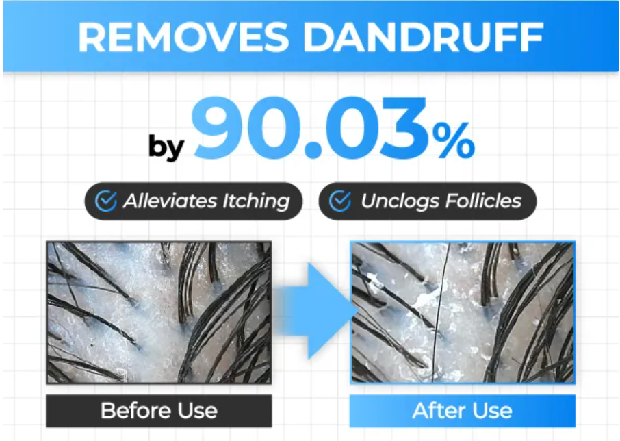 Seapuri - Scalpy Hair Serum 20ml