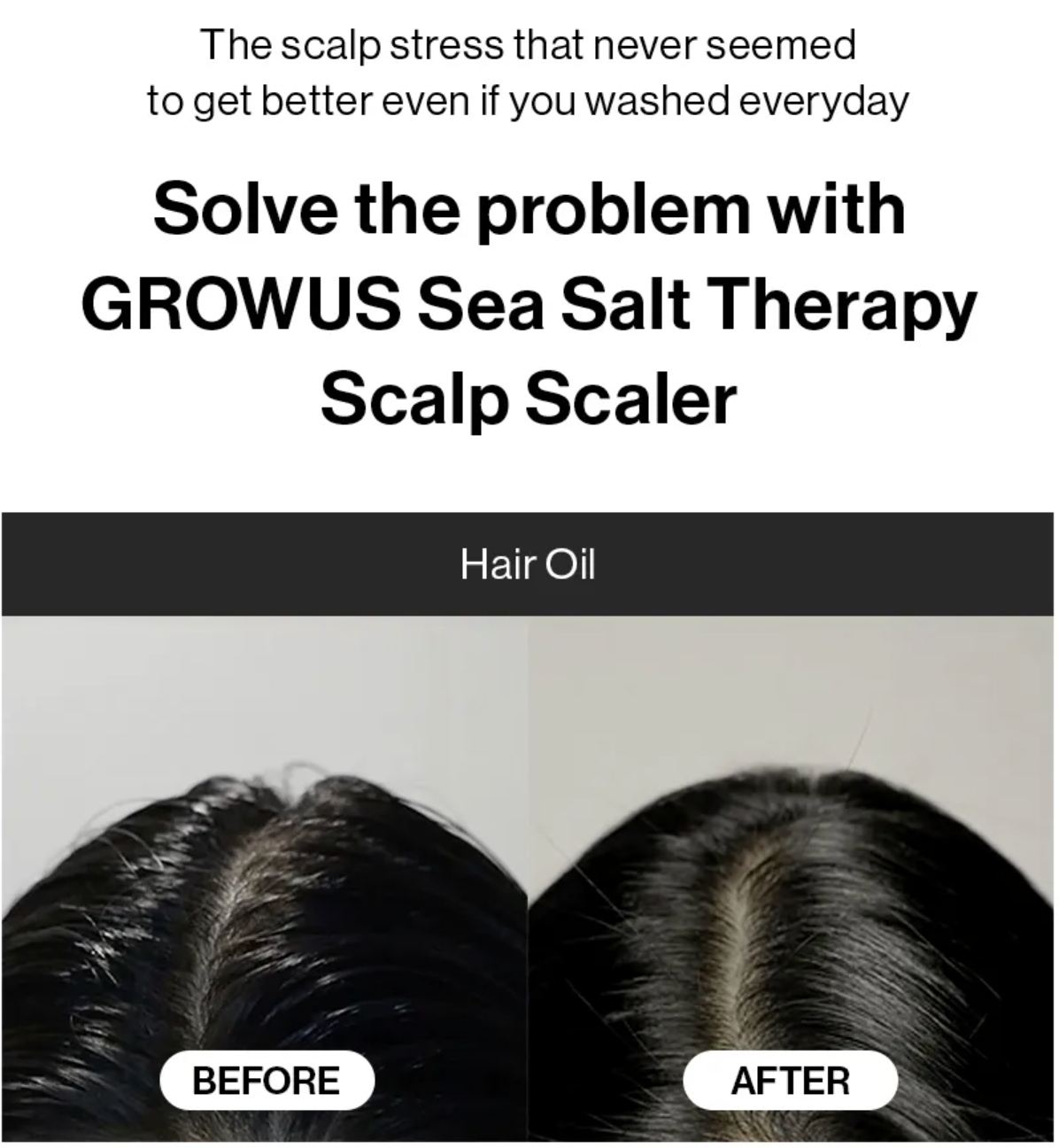 GROWUS - Sea Salt Therapy Scalp Scaler
