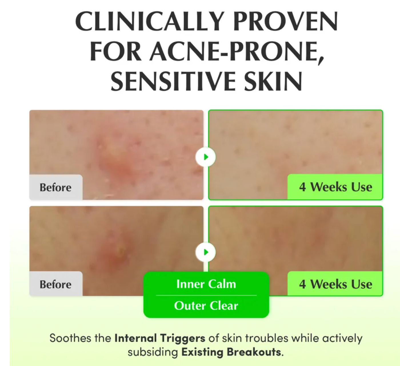 EQQUALBERRY - Aloe PDRN Calming Toner