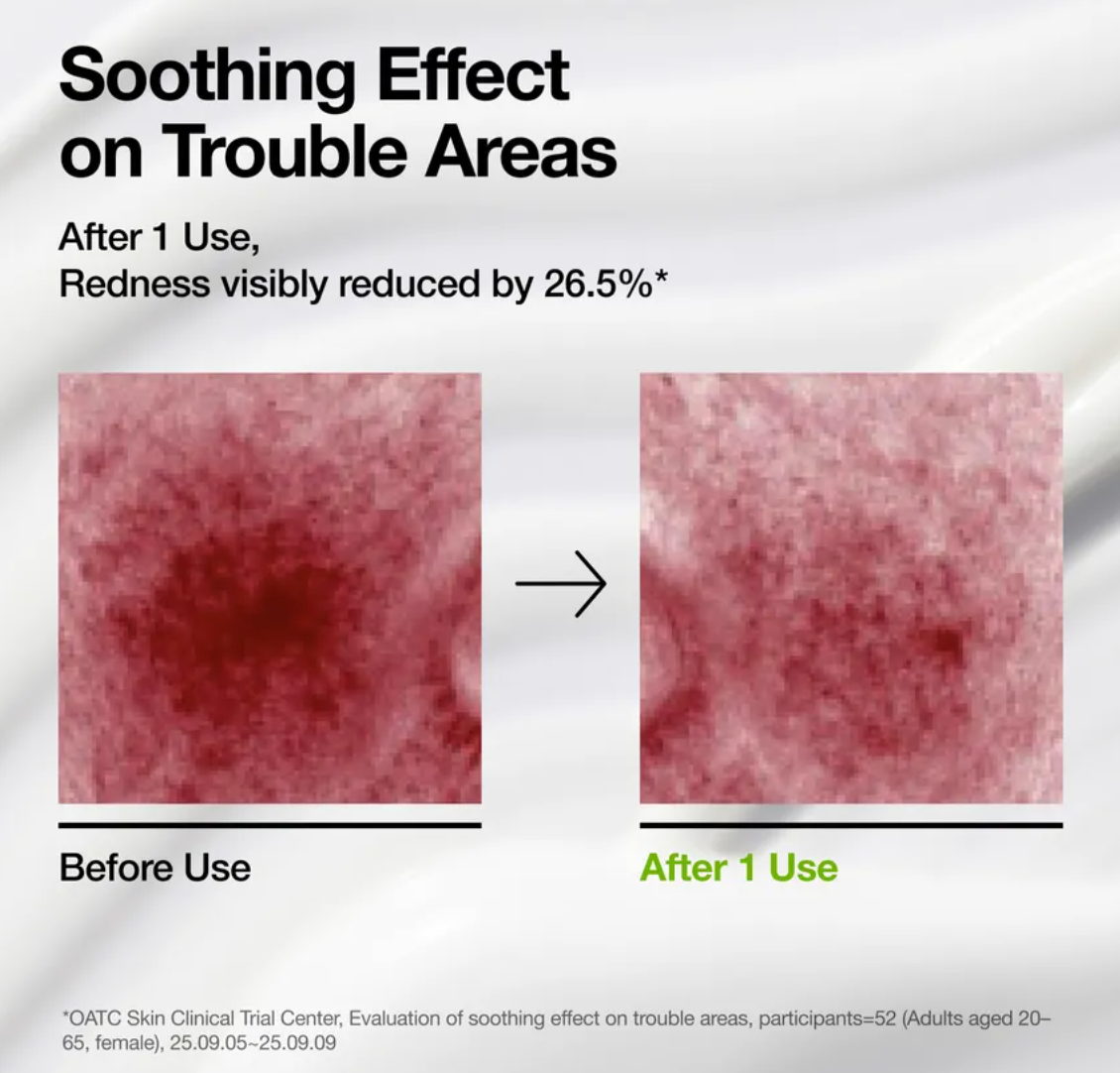 Anua - Azelaic Acid Cica Skin Soothing Moisturiser