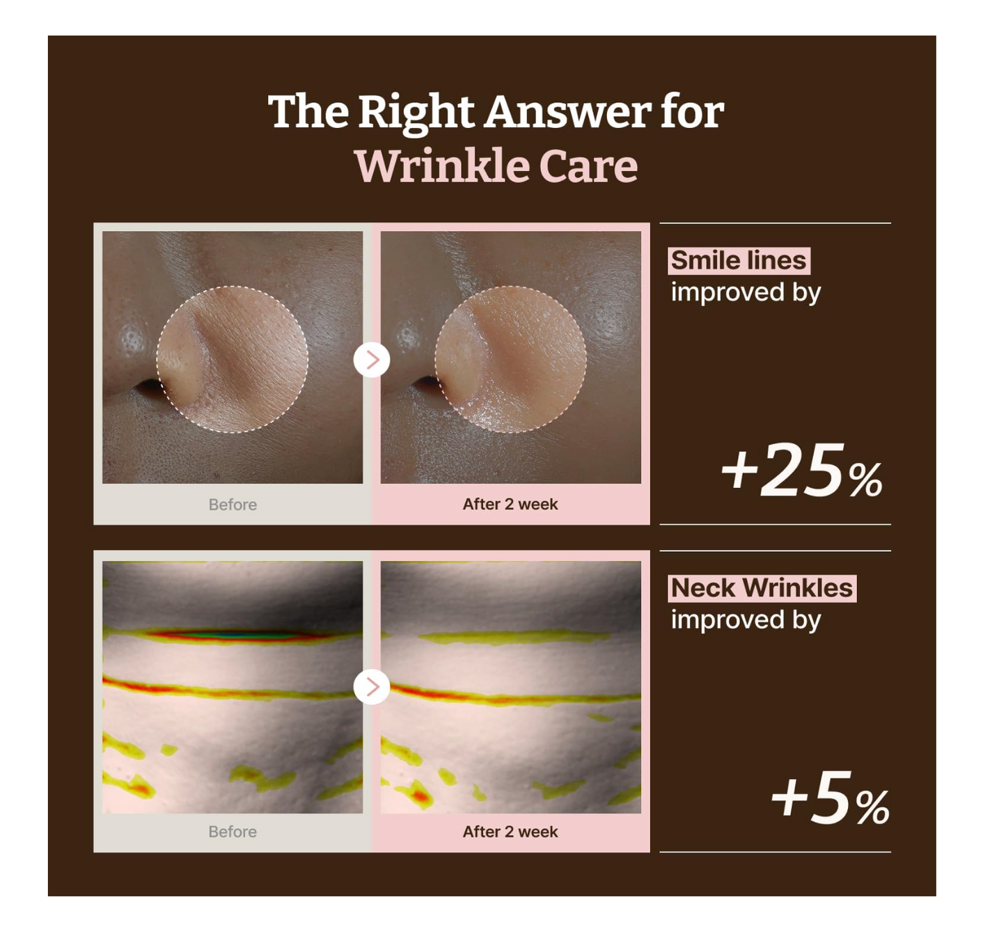 Dr Rejuall - All Advacned PDRN Rejuvenating Mask – Face & Neck 1 ea