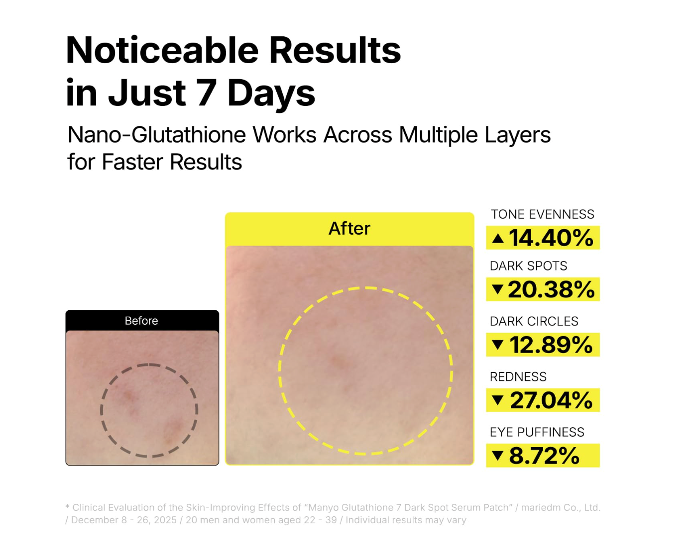 ma:nyo - Glutathione 7 Dark Spot Serum Patch