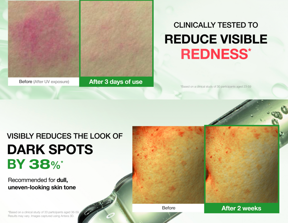Physiogel - Red Soothing Rosacea Redness Reducing Serum 30ml